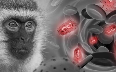 MPOX o Viruela del Mono